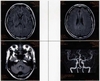 HEAD_MRI.jpg